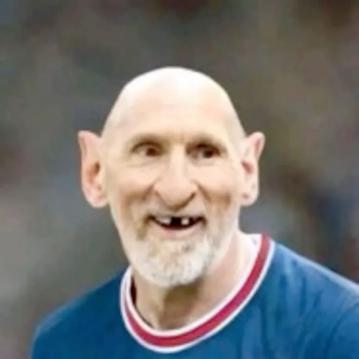 Messi với mái đầu trọc và hàm răng sún độc lạ