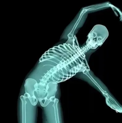 Avatar đôi bộ xương x quang