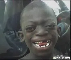 Cậu bé da đen Nhe răng cười cực ngầu mạng xã hội.