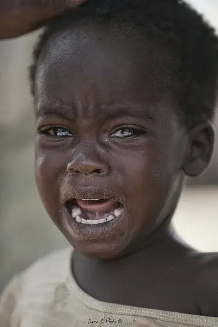 Em bé da đen khóc rất đau khổ