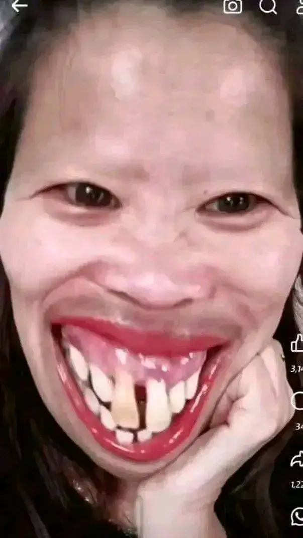 Meme cười sảng khoái, khiến bạn bè cười rụng răng.