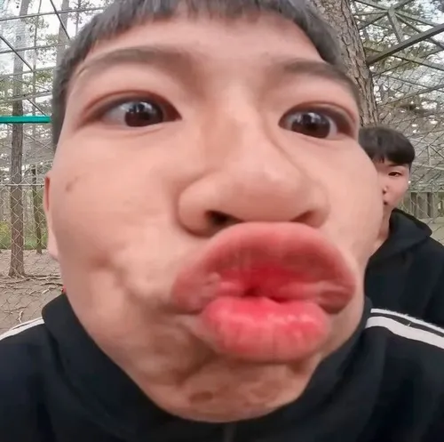 Meme chu môi gây ấn tượng nhờ biểu cảm quá đà.