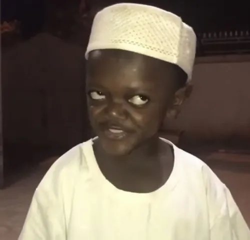 Cậu bé đa đen với gương mặt như thiểu năng trí tuệ