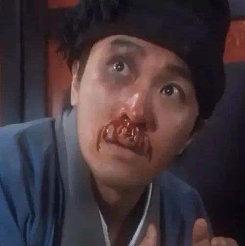 52 ảnh Meme Chảy Máu Mũi do bị kích thích bởi "sự nóng bỏng" phong cách hài hước