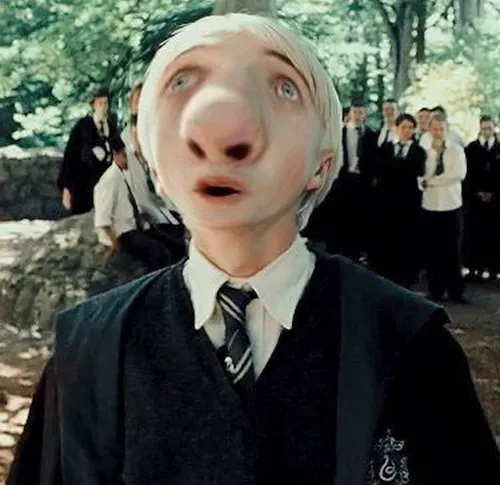 Ảnh hài thiểu năng với nụ cười khờ khạo đáng yêu cực độ