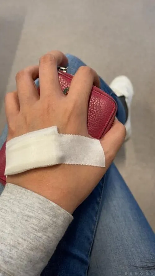 Ảnh đứt tay chân thật dùng để xem người yêu có hoảng không