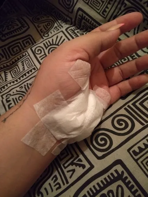 45 Ảnh Đứt Tay Troll (hình thực tế) cực hợp thử lòng người yêu bạn thân