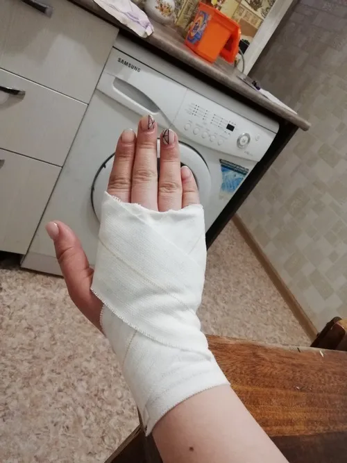 Hình chụp đứt tay rõ ánh sáng phản chiếu trên giọt máu