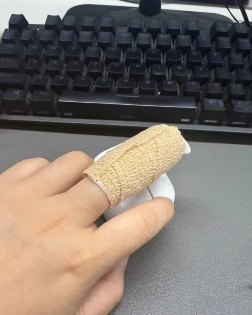 Ảnh đứt tay thực tế tạo tình huống xem ai quan tâm bạn nhất