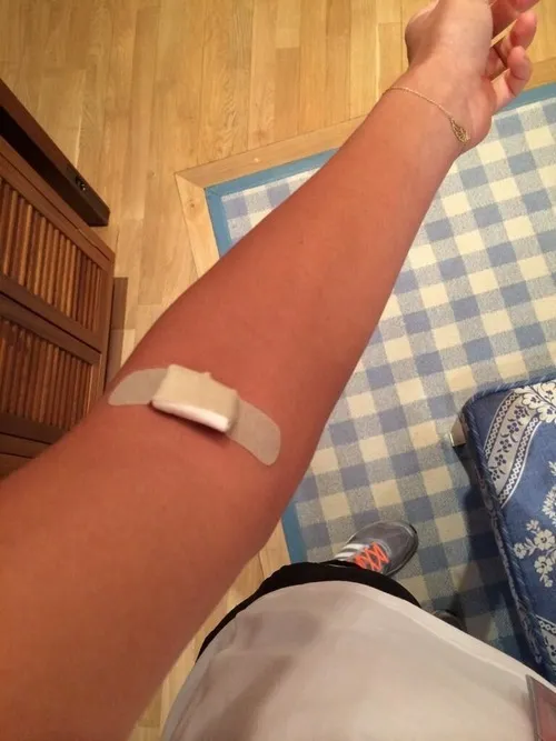 Ảnh rách da thể hiện lớp biểu bì bong nhẹ dưới ánh sáng trắng.