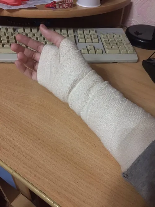 Ảnh đứt tay làm nổi bật đường cắt thẳng do dao nhỏ tạo nên.