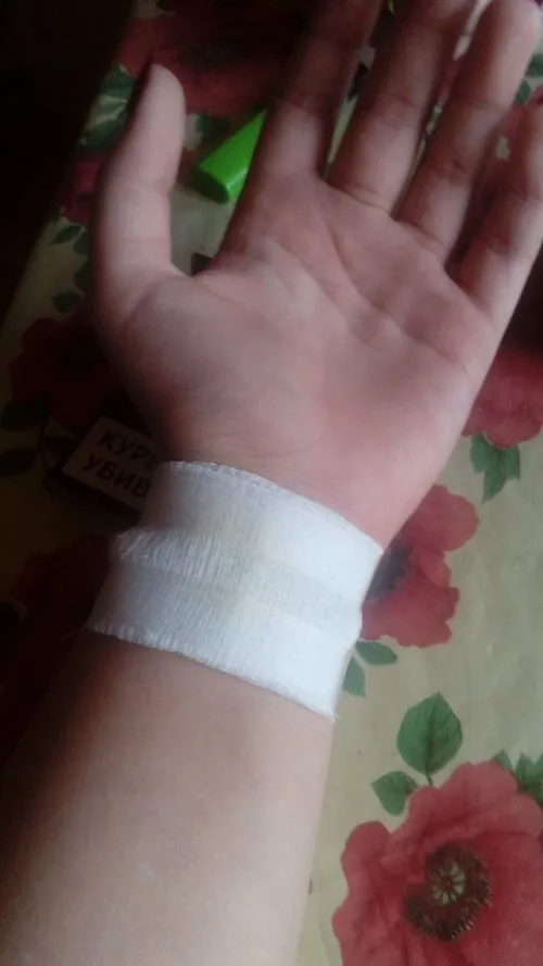 Ảnh đứt tay bắt trọn khoảnh khắc người bị thương giữ tay dưới vòi nước.