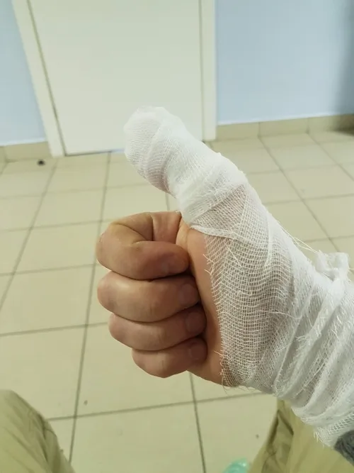 Ảnh đứt tay ghi lại ánh sáng phản chiếu trên giọt máu mới chảy.