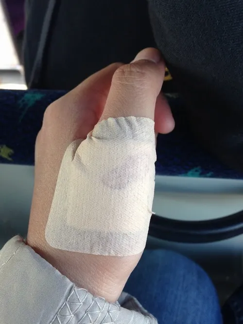 Ảnh rỉ máu thể hiện từng vệt nhỏ loang dần trên da.