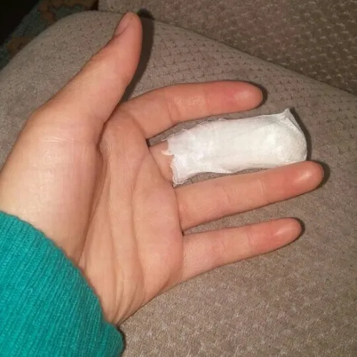 Hình chụp đứt tay thật giúp xem người yêu lo lắng đến đâu