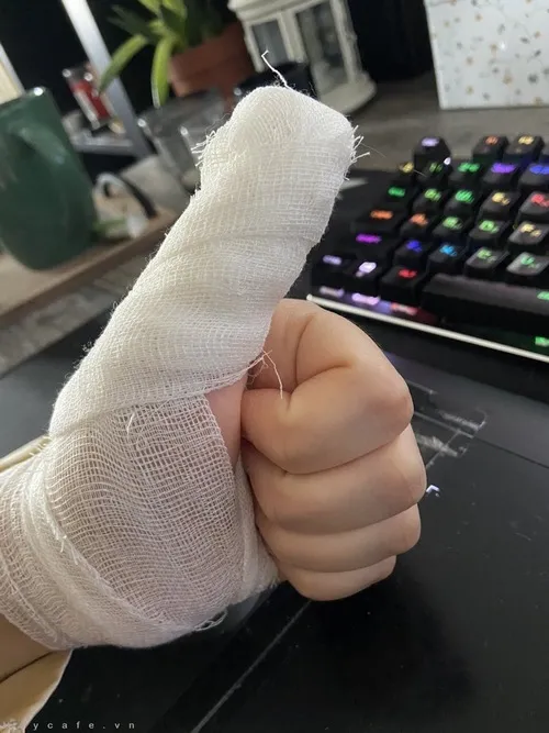 Ảnh xước tay thể hiện vết trượt dài do cạnh giấy gây ra.