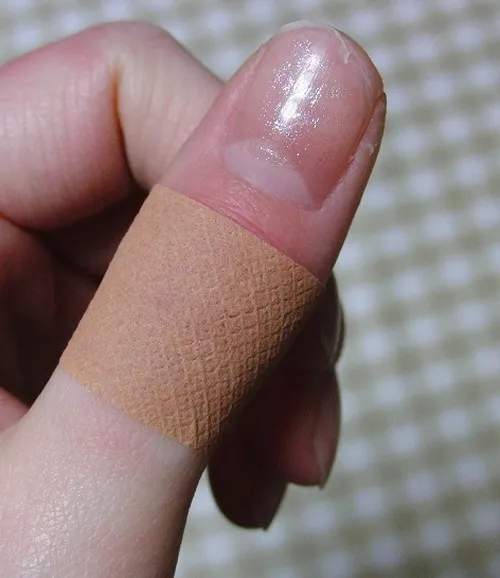 Ảnh sướt móng ghi nhận lớp móng sứt cạnh để lộ phần thịt hồng.