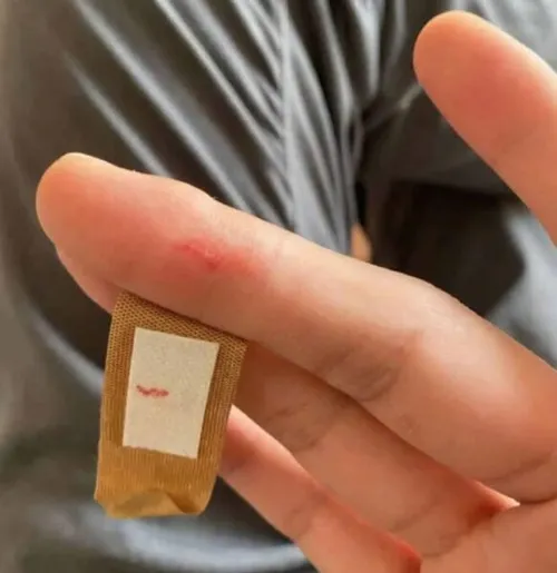 Ảnh đứt tay thật ghi lại khoảnh khắc dùng để thử lòng người yêu